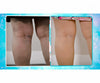 Veins Gone 2x1 a 972 CZK